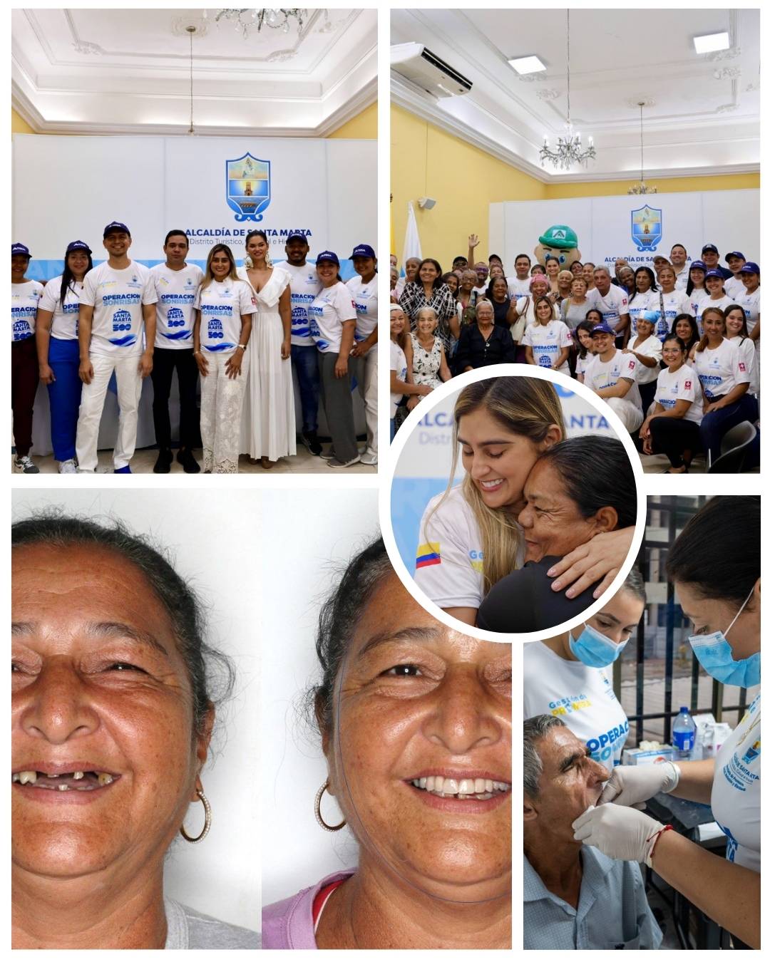 “Operación Sonrisas” Administración de Carlos Pinedo entrega 60 prótesis dentales a personas en situación de vulnerabilidad